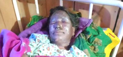 हुम्लामा डढेलो निभाउने क्रममा एक महिला घाइते